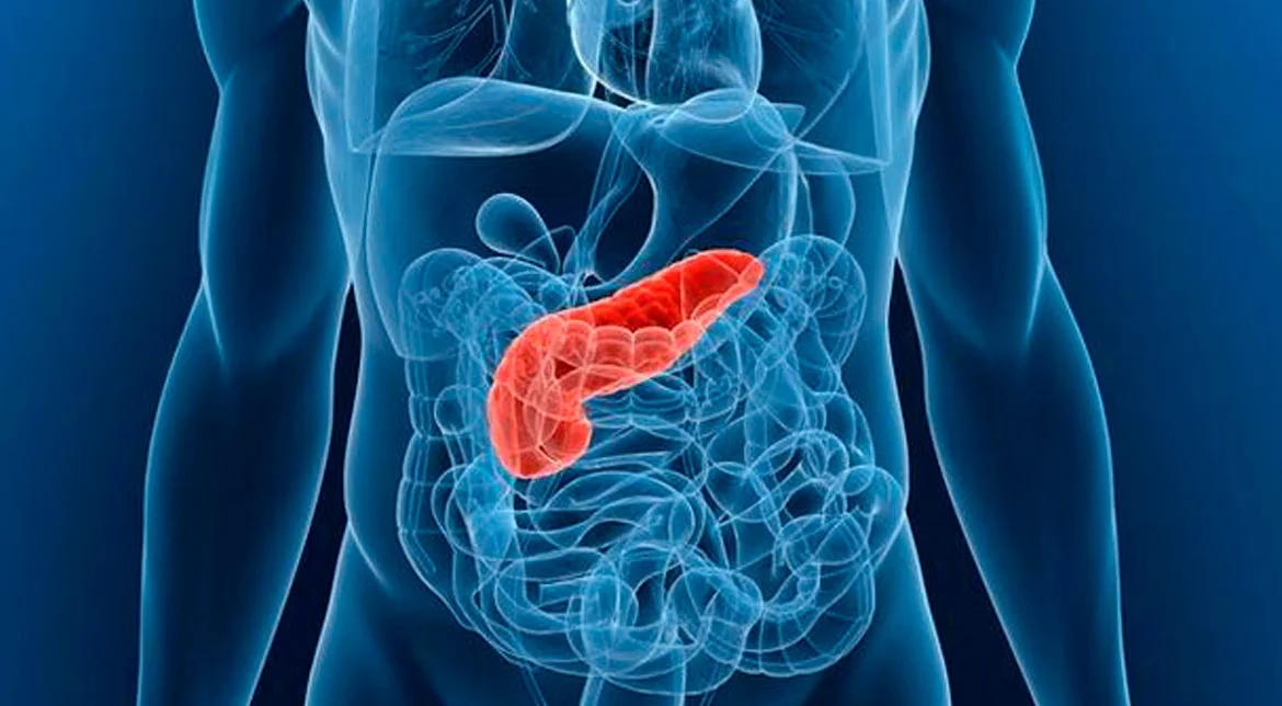 Pancreatitis Aguda y Crónica: Diagnóstico, Manejo y Seguimiento